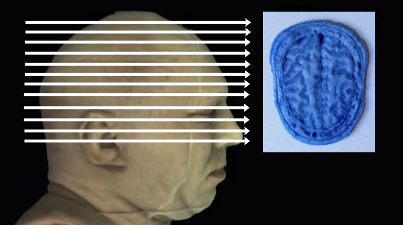 Click on arrow links to select 3D print of slice from that level of head.