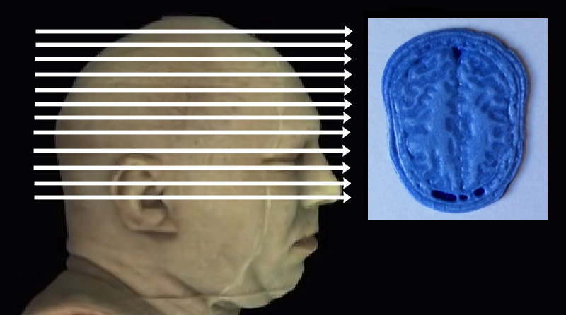 Click on arrow links to select 3D print of slice from that level of head.
