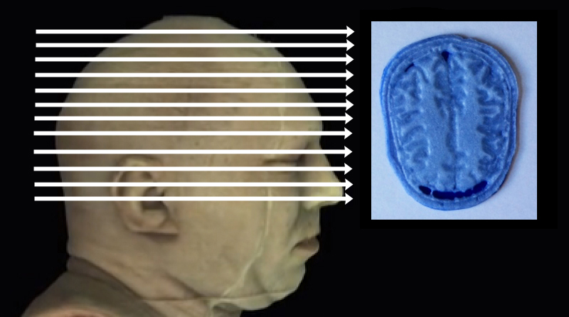Click on arrow links to select 3D print of slice from that level of head.