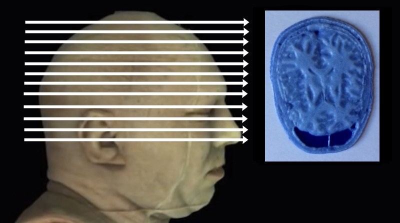 Click on arrow links to select 3D print of slice from that level of head.