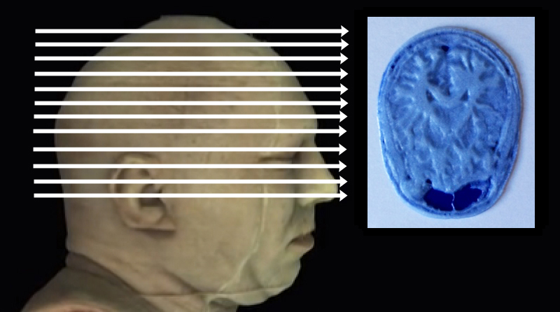 Click on arrow links to select 3D print of slice from that level of head.