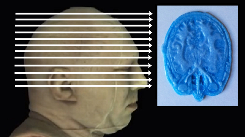 Click on arrow links to select 3D print of slice from that level of head.