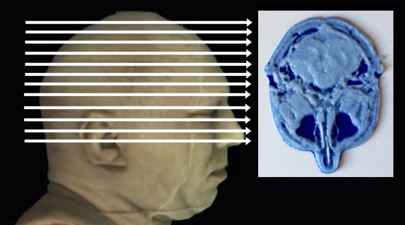 Click on arrow links to select 3D print of slice from that level of head.