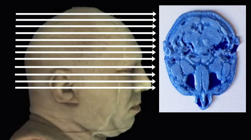 Click on arrow links to select 3D print of slice from that level of head.