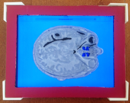 Image shows 3D printed audio-enriched template held in place atop an iPad with audio buttons ready to fire when the 3D print with conductive paint is touched.
