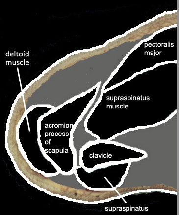 digital image of human shoulder section 1280 with muscle and bone areas labeled.